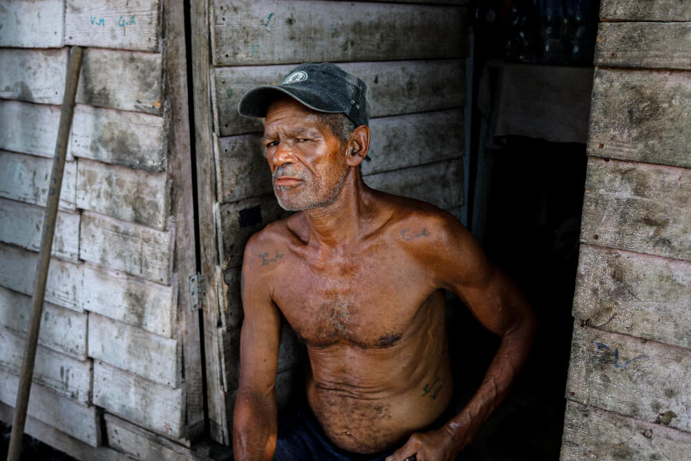 Domício é um homem negro de 60 anos; na foto ele está sem camisa e mostra as cicatrizes que ganhou trabalhando no lixão