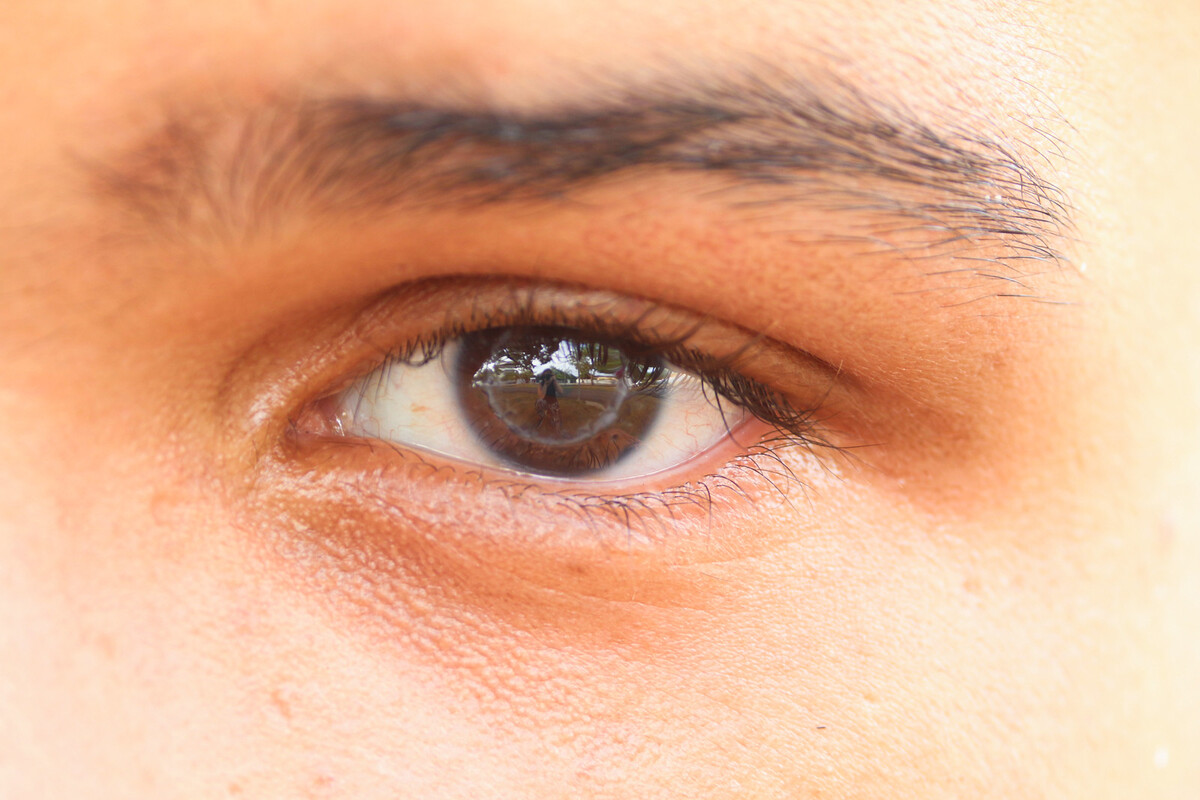 Na foto, Mateus Miranda da Silva (realizou transplante de córnea no olho esquerdo em 2024, e aguarda na fila para realizar o procedimento do olho direito)